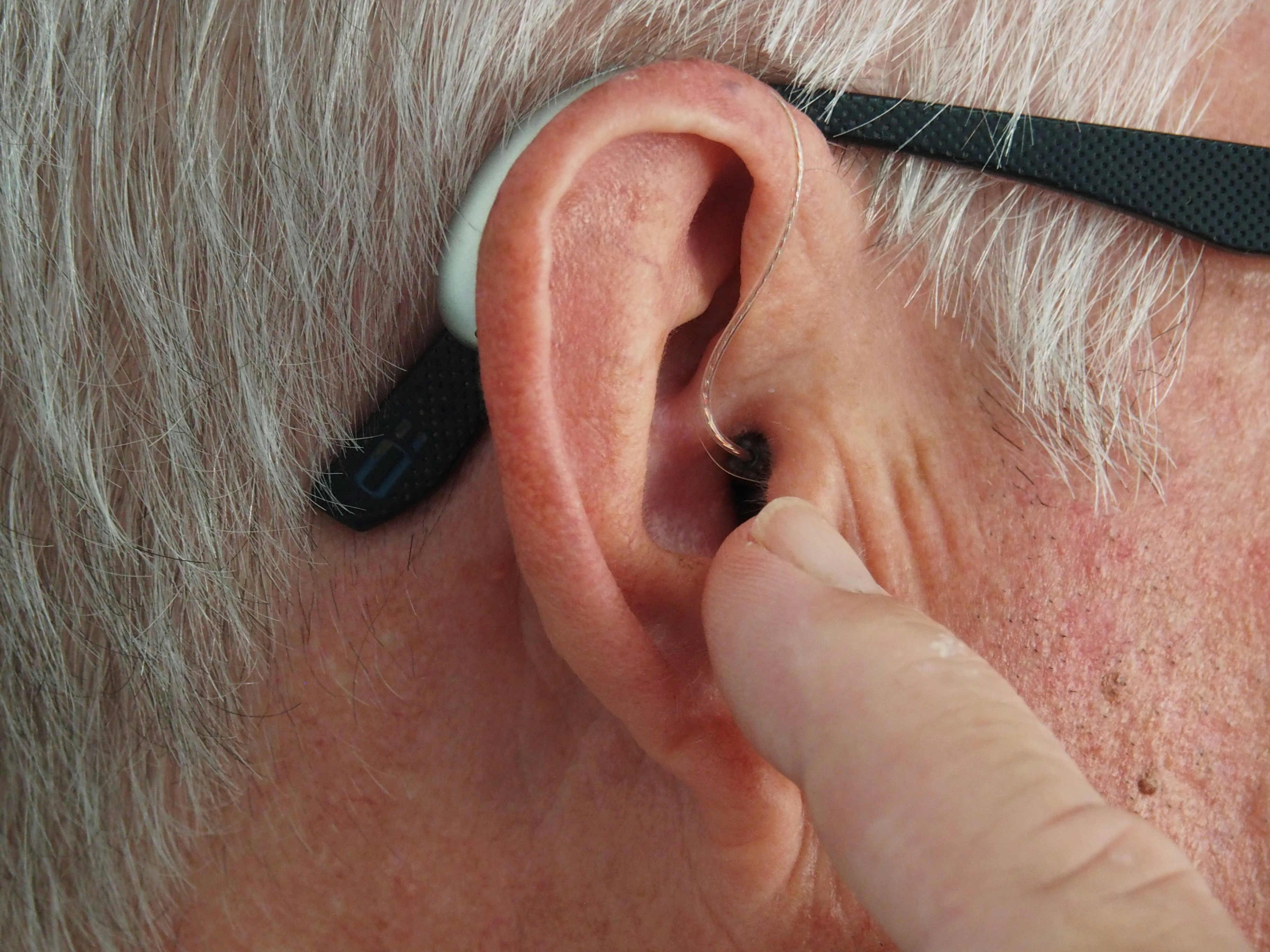 What Are the Most Common Causes of Hearing Loss? 1 img